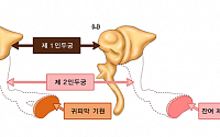 &quot;선천성 이소골 기형 난청환자, 수술 전 CT로 기형 분류 예측 가능&quot;