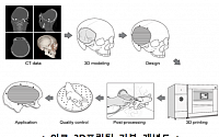 한국이 제안한 '3D 프린팅 의료 보형물', 국제 표준 채택