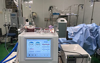 분당서울대병원 개발한 국산 '에크모', 폐이식 환자 치료에 첫 성공