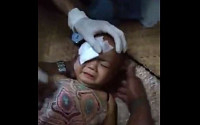 &quot;어린이에게도 무차별 사격&quot; 1살 아기에게 고무탄 쏜 미얀마 군경