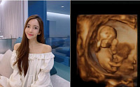 배우 이필립-박현선, 부모 된다…결혼 1년 만의 임신 “선물처럼 찾아온 곰동”