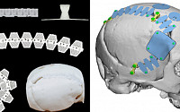 티앤알바이오팹, 3D 바이오프린팅 ‘두개안면골 임플란트’ 특허 취득