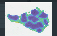 뷰노, 美 임상종양학회서 ‘AI 기반 간암 디지털 바이오마커’ 연구결과 발표