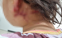 [랜선핫이슈] 4세 아이 덮친 맹견·수리부엉이에 짱돌 던진 유튜버·모유서 자외선 차단제 검출