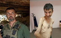 러시아서 생환한 우크라 군인, 고문에 뒤틀린 팔과 처참한 몰골…4개월만의 흔적