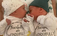 美 30년 전 냉동 배아서 태어난 쌍둥이…원래라면 92년생 '세계 최장 기록'