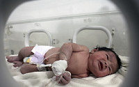 시리아서 탯줄 단 채 구조된 아기 이름은 ‘기적’
