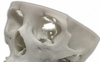 메디쎄이, 3D프린팅 환자맞춤형 ‘인공 턱뼈’ 미국 특허 취득