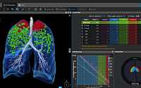 코어라인소프트, 유럽 대형 병원‧영상센터에 AI 솔루션 공급