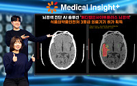 SK C&amp;C, 뇌경색 진단 AI 솔루션 식약처 허가 획득
