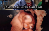 박수홍♥김다예 부부, 임신 12주차 기형아 검사 결과…"조산 가능성 없다"