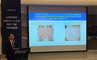 한국애브비 “스카이리치, 손발바닥 농포증 새 치료 옵션될 것”