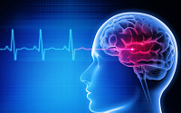 ‘환자 38.8%는 장애’…뇌졸중 신약 열 올리는 제약·바이오 업계