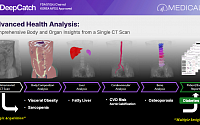 메디컬아이피, 'DeepCatch' 활용 논문 국제학술지 게재