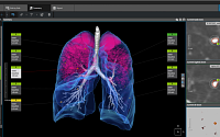 ﻿코어라인소프트, 국제 폐기능 영상의학회 참가…흉부질환 진단 솔루션 선보인다