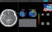 제이엘케이, ‘뇌졸중 대혈관폐색’ 솔루션 美 FDA 승인
