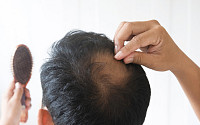 탈모 막자, 중년 남성 맞춤 두피 건강 관리법은?