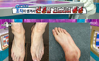'라디오스타' 차준환, 충격적인 발목 사진⋯"스케이트 닿는 부분 조직 생겨"