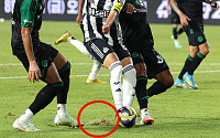 손님 불러놓고…팀 K리그 vs 뉴캐슬전 잔디 논란