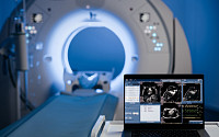 글로벌 의료영상기기 시장, 2032년 90조 원 돌파 전망