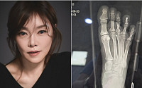 차지연, 공연 앞두고 발가락 골절상⋯"회복 빨라, 불편하지만 무대 설 것"