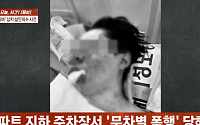 유튜버 수탉, 처참한 납치 폭행의 흔적⋯사진 속 안와골절 모습 충격