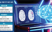 AI 기반 의료기기 각축전…혁신성·해외 시장 성과 속속