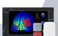 뉴로핏, 삼성서울병원에 ‘개인 맞춤형 tDCS 솔루션’ 첫 공급