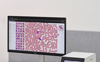 노을, 루마니아에 AI 기반 혈액 분석 솔루션 공급⋯유럽 판매 가속