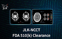 제이엘케이, 비조영 CT 기반 뇌졸중 분석 솔루션 美 FDA 510k 획득