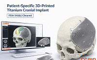 시지바이오, 환자맞춤형 티타늄 임플란트 ‘이지메이드 TI’ 美 FDA 허가