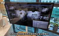 “난자 7개 준비돼 있습니다”…난자 동결 2주 프로젝트, 사실상 임신 준비 같아 [붙잡은 미래, 냉동난자 上]