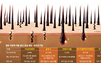 탈모도 ‘혁신신약’ 개발 열풍…주인공 누가 될까[자라나라 머리머리]