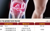 미충족 수요 큰 ‘골관절염’…해외에서 잘 나가는 국산 신약들[K-제약 글로벌 확장②]
