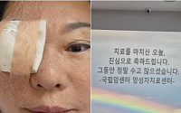 양희은, 각막이식에 이어 방사선치료도 마무리⋯"씩씩하게 견뎠다"