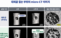 자생한방병원, 한약재 방풍의 뼈 재생 촉진 효과 최초 규명