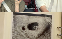 전진♥류이서, 시험관 임신 성공했지만⋯7주 만에 유산 “다시 도전할 것”