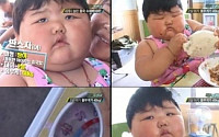 '40kg 2살 아이', 뭘 먹었길래…경악!