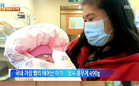 '490g의 기적' 다섯 달 만에 태어난 아기, 네티즌들 &quot;건강하게 무럭무럭 자라나길&quot;응원 쇄도