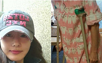 ‘로이킴의 연인’ 김지수 인대파열, 소속사 측 “큰 부상 아니니 걱정 마세요”