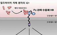 서울대 연구팀, 알츠하이머 유발 단백질 규명