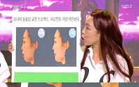 '씨스타29' 오나미, 돌출입 교정 전이나 후나 &quot;어? 오나미다!&quot;