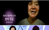 렛미인 ‘반쪽얼굴 소녀'경악 후 대반전, 어쩌다?