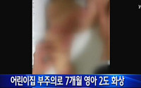 생후 7개월 아기 '어린이집 부주의'로 2도 화상