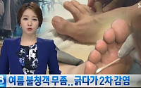 무좀 예방법 &quot;지금도 늦지 않았어… 따라해 봐&quot;