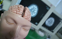 뇌졸중의 종류와 원인… '뇌경색'과 '뇌출혈' 차이는?