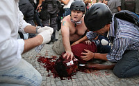 [포토]시위 보도하다 부상당한 브라질 카메라맨