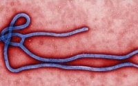 에볼라 바이러스 기니 수도에서 발병, 추가 발병은 짐바브웨?…치사율 90%에 긴장감 커져