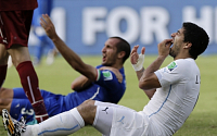 FIFA, '이탈리아 우르과이전' 수아레스 핵이빨 조사 들어가...이빨자국 보니 '선명'