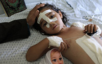 [포토] 이스라엘 공습으로 다친 팔레스타인 아이